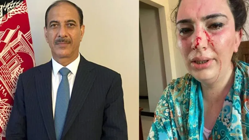 Silsila Alikhil, fiica ambasadorului afgan la Islamabad Najibullah Alikhil, a fost "răpită câteva ore" de necunoscuţi şi "eliberată după ce a fost torturată". / Foto: opindia.com