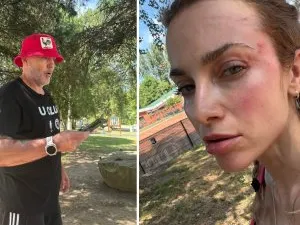 O femeie a fost snopită în bătaie de un fan U Cluj în parc: ”Mi-a spus că sunt ucraineancă și că nu am niciun drept să fiu aici”
