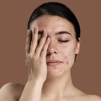 Retinol de casă obținut din două ingrediente din bucătărie. Elimină ridurile și stimulează colagenul - Foto: Istock / imagine cu rol ilustrativ