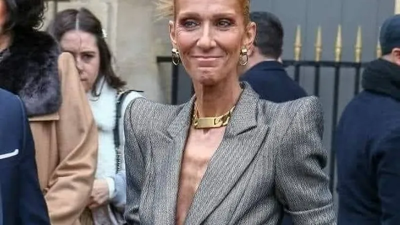 Celine Dion suferă de distrofie musculară. A ajuns la 40 de kilograme și nu mai poate să meargă. / Foto: unica.ro