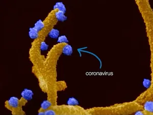 Celule infectate cu Sars-Cov-2.