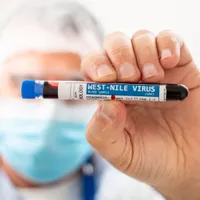 Virusul West Nile - Foto: Profimedia images