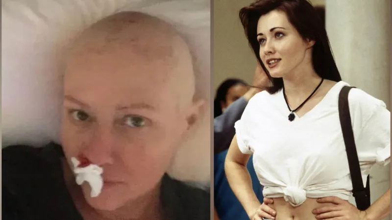 „Brenda” din serialul Beverly Hills, în stare gravă - Foto: Profimedia Images