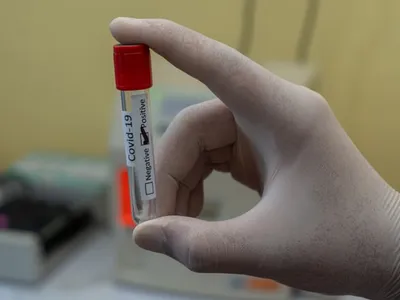 Coronavirus: 159 de cazuri noi de COVID-19 și un singur deces înregistrat în ultima zi în România/FOTO: Unsplash