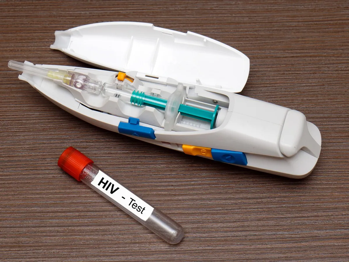 Test HIV - Foto: Profimedia images