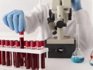 Probe de sânge pentru analize la coronavirus - Foto: Freepik/CC0