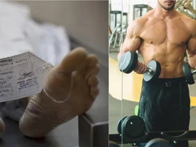 Oamenii care își injectează grăsime din cadavre ca să „poată spune că au mers la sală”: Cum a apărut noua modă „zombi filler”