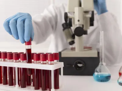 Probe de sânge pentru analize la coronavirus - Foto: Freepik/CC0