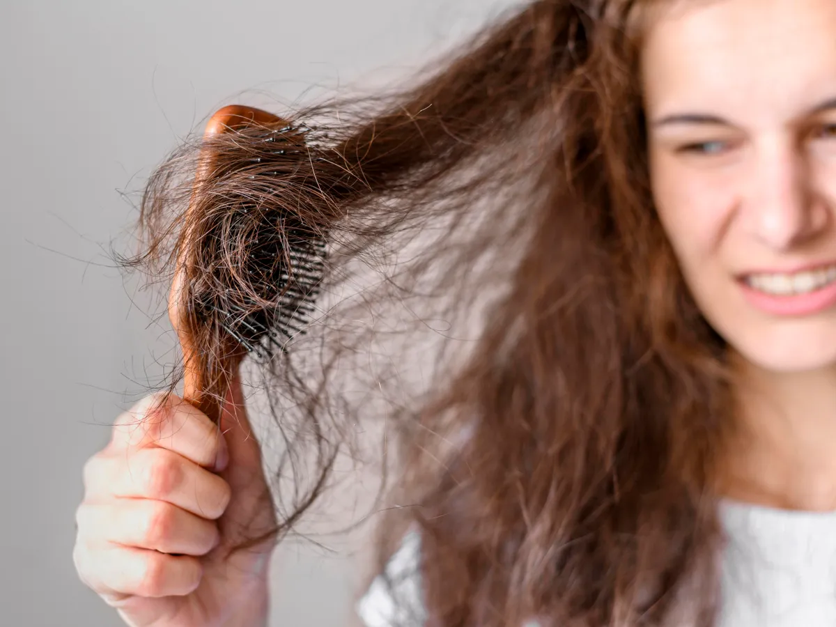 femeie care are alopecie Foto : Freepik (rol ilustrativ)