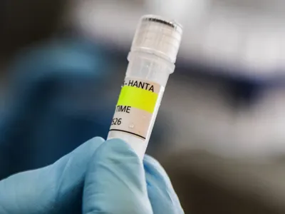 Hantavirus Foto: AFP