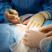 Penisul unui bărbat a fost amputat din greșeală după ce a fost diagnosticat greșit cu o tumoare