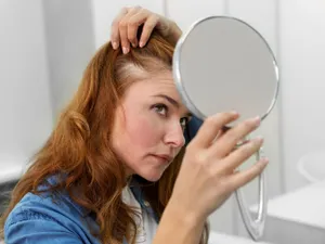 Cum să reduci căderea părului în mod natural, fără suplimente sau produse cosmetice costisitoare - Foto: Freepik (Imagine cu rol ilustrativ)