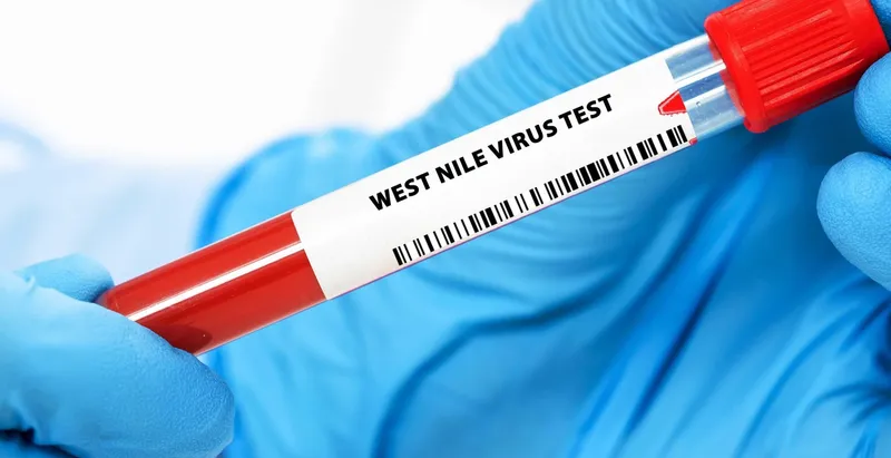 wirus west nile