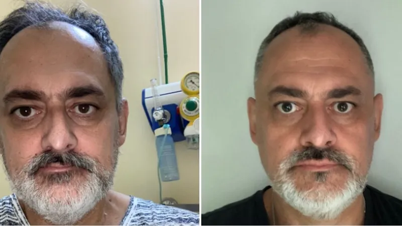 Gabriel Toma a povestit, pe Facebook, cu ce probleme de sănătate se confruntă la un an decând a avut boala. Srsă: Facebook RoVaccinare