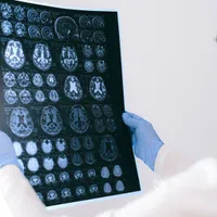 Cum se simte primul bărbat cu un cip implantat în creier? Va mișca cursorul doar cu mintea - Foto: Pexels (Imagine cu caracter ilustrativ)