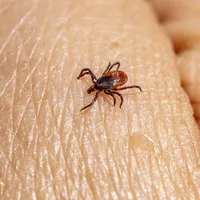 Alertă de sănătate. Căpușele transmit un virus mortal care „se îngroapă în creierul” omului - Foto: Pixabay.com (rol ilustrativ)