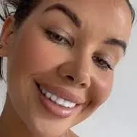 VIDEO O vedetă a plătit 3.500 € pentru o dantură albă, de vis. Au anunțat-o că îi vor cădea dinții / tiktok