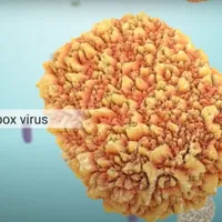 E grav: OMS a declarat epidemia de mpox o urgenţă de sănătate publică de interes internațional - Foto: captura Youtube(imagine cu rol ilustrativ)