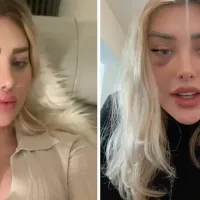 Weronika a avut de suferit din cauza unei operații estetice- Foto: TikTok
