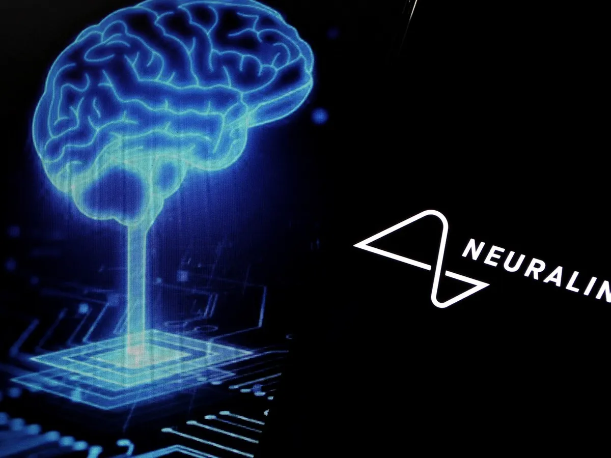 Neuralink - Foto: Profimedia images