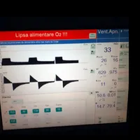 Monitor care prezintă lipsa oxigenului/FOTO: turnulsfatului.ro