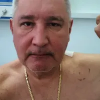 Îmbătrânit şi obosit, Dmitri Rogozin distribuie prima sa poză, după ce a fost rănit în Doneţk - Foto: Nexta on Twitter