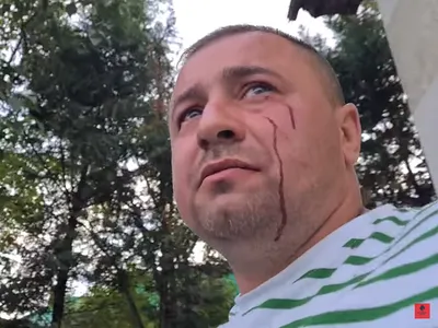 Activistul Robert Nițu a fost urmărit de interlopi care i-au tamponat mașina și l-au bătut chiar și de față cu polițiștii Foto: captură Youtube