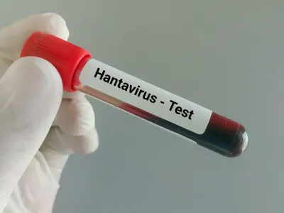 Ce este hantavirusul, infecția care a provocat trei decese pe o navă de croazieră. Ce riscuri există în România
