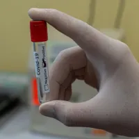 Coronavirus: 159 de cazuri noi de COVID-19 și un singur deces înregistrat în ultima zi în România/FOTO: Unsplash
