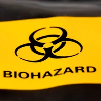 Nebunia lui Putin continuă. Rusia ar putea pregăti arme biologice, variolă și Ebola - Foto: Profimedia images