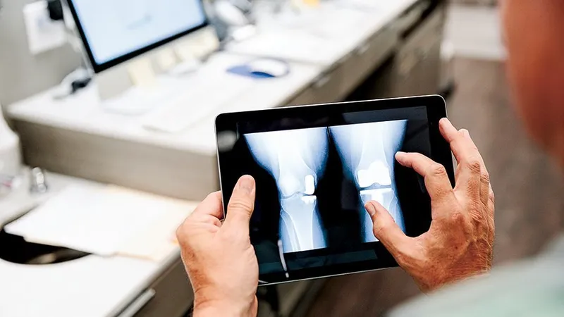 Un doctor privește radiografiile unui genunchi pe o tabletă