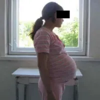 Zeci de mame de 14 ani lăsate în voia sorţii. Foto Monitorul de Botoșani