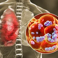Epidemia gravă care a lovit grav un oraș din România. 3 pacienți au murit, alți 120 sunt internați - Foto: Profimedia images