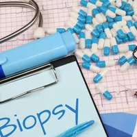 Puncţia-biopsie făcută răspândeşte cancerul? Mitul care duce la înrăutăţirea stării de sănătate - Foto: pix4free/Nick Youngson/CC BY-SA 3.0