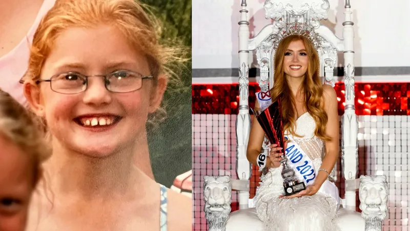 „Tocilara” umilită colegii de clasă a ajuns Miss Anglia. Acum are toată lumea la picioare - FOTO: Profimedia