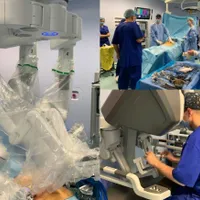 Prima operaţie asistată robotic din Moldova. Pacientul avea cancer la colon