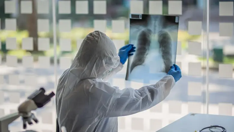 Radiografie pulmonară a unui bolnav de COVID/FOTO: Getty