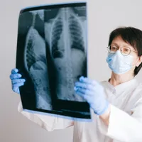Medicii au văzut ceva suspect la radiografie (foto cu caracter ilustrativ) Foto: pexels.com