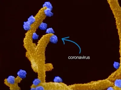 Celule infectate cu Sars-Cov-2.