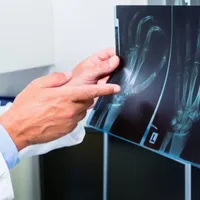 Ce sentință a primit un medic care și-a împins fosta soție pe scări. Judecătorii au fost „blânzi” - Foto: Ziarul de Iași/ Imagine cu caracter ilustrativ