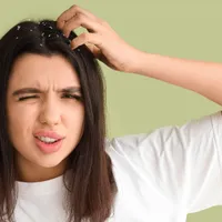 Ingredientele din bucătărie care te scapă de dermatită și îți fac părul să strălucească - Foto: Profimedia Images (imagine cu rol ilustrativ)