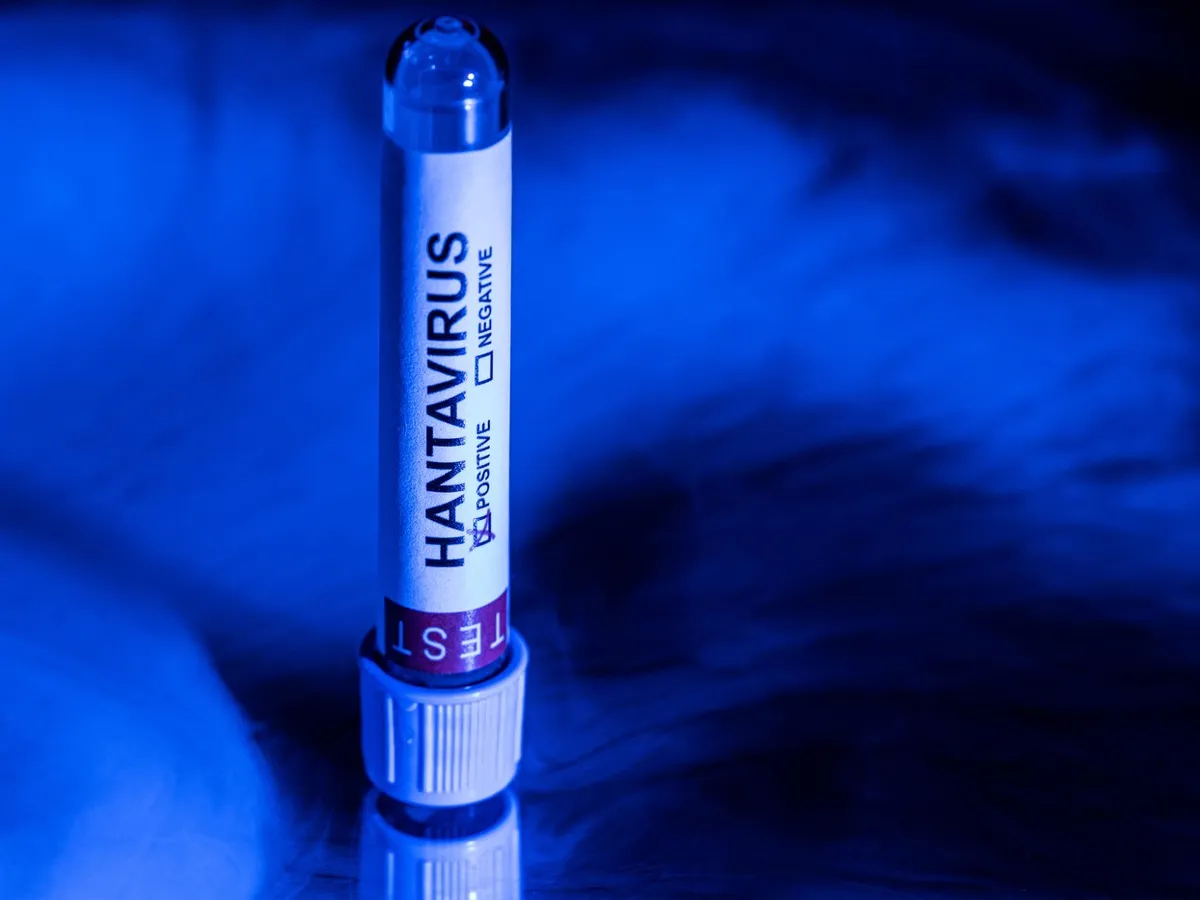 Hantavirus - Foto: Profimedia Images (imagine cu rol ilustrativ)