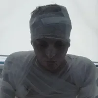 Măriuca, tânăra de 17 ani din Mehedinți care a fost incendiată de un criminal în serie care fusese eliberat condiționat/FOTO: HotNews.ro