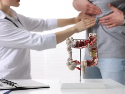Testul care îți arată dacă ai cancer de colon, doar dintr-o picătură de sânge. Cât e de precis? - Foto: Freepik (imagine cu rol ilustrativ)