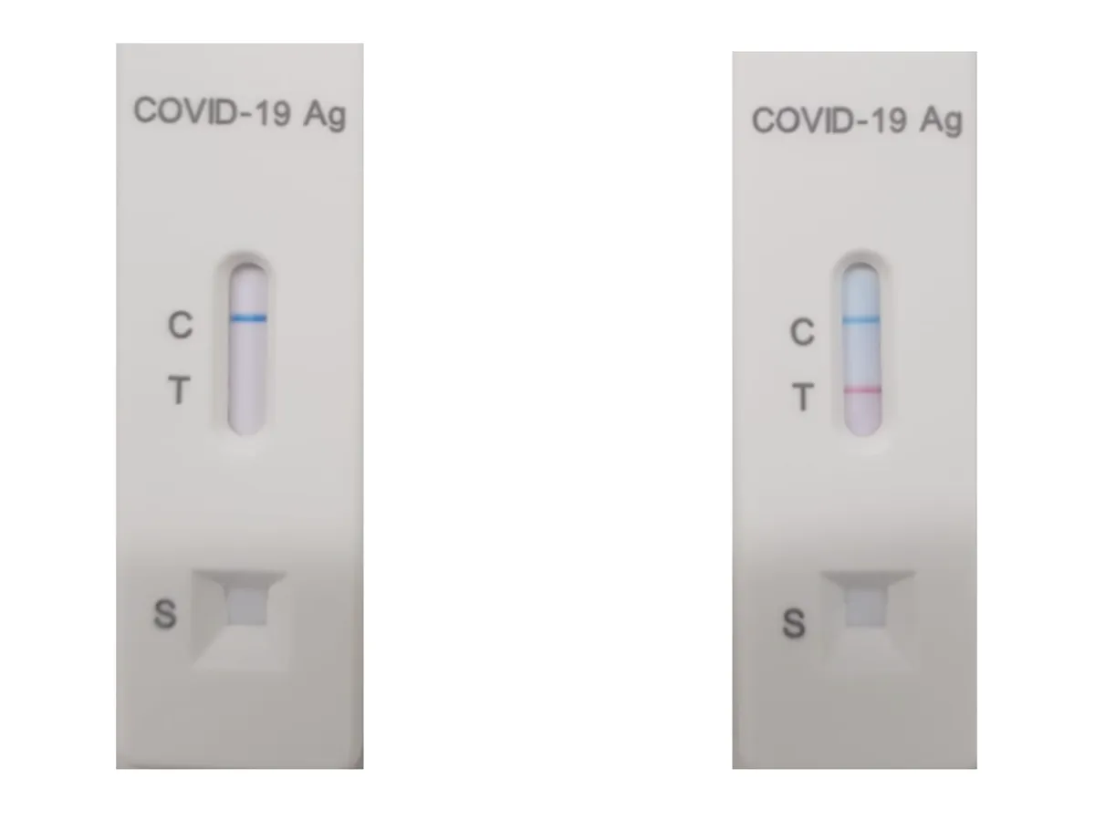 Interpretare test antigen Foto: DDS DIagnostic
