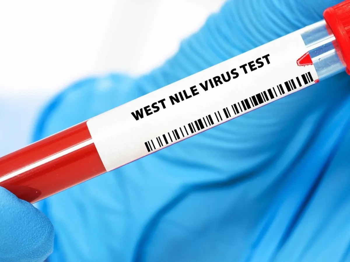 wirus west nile