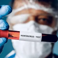 Hantavirus - Foto: Profimedia images