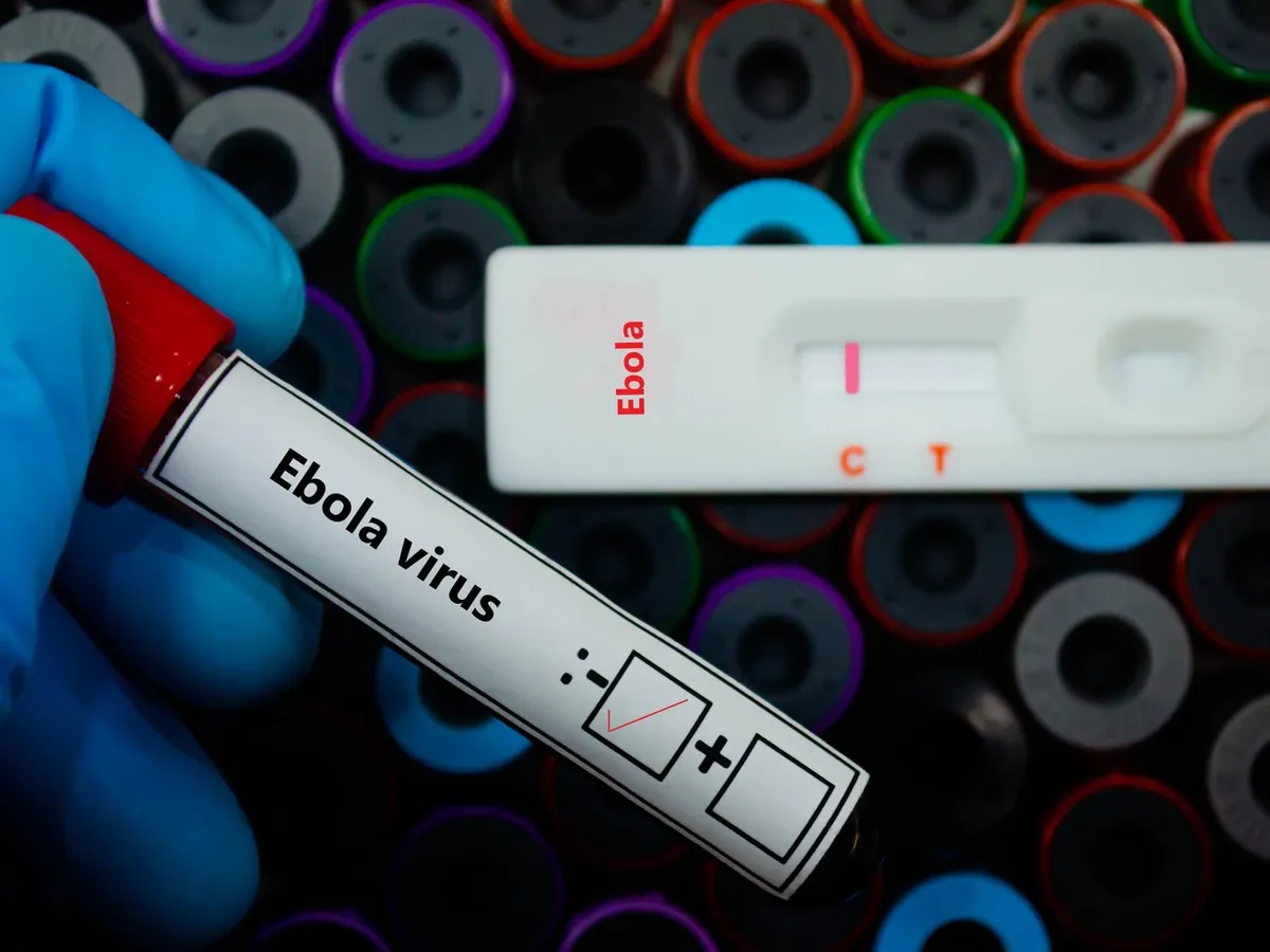 Ebola - Foto: Profimedia images