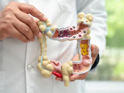 Numărul persoanelor sub 50 de ani cu cancer intestinal, în creștere - Foto: Freepik (imagine cu rol ilustrativ)