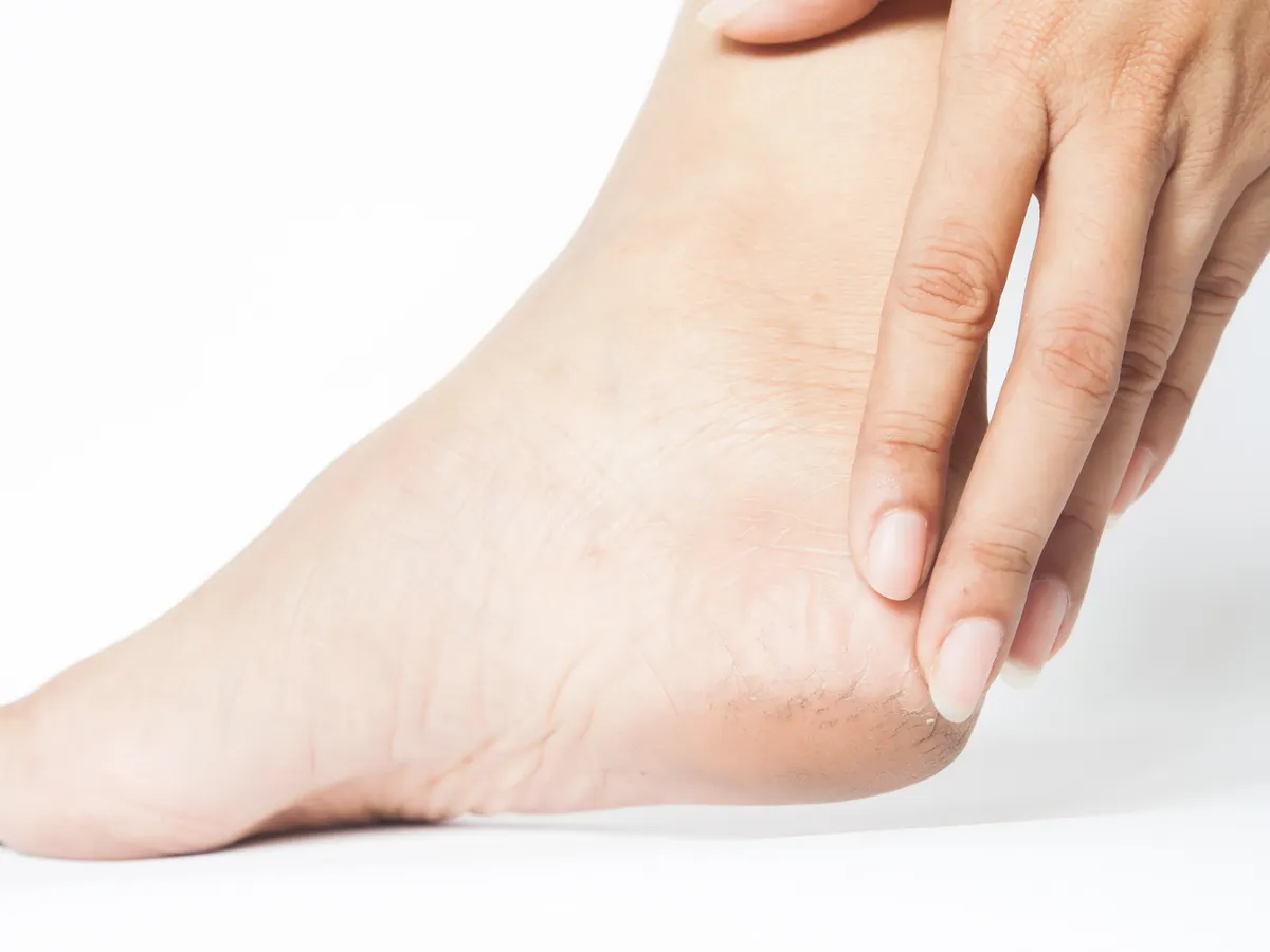 Aruncați cremele pentru călcâiele uscate! Un truc care costă doar 10 lei face pielea de bebeluș din prima